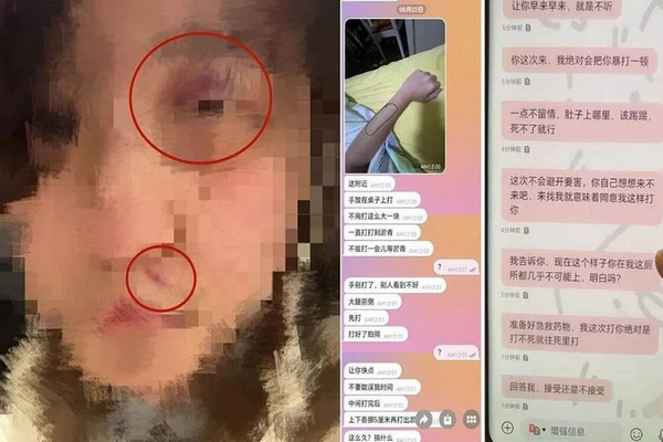缩略图 | 17岁女生控诉大一男生对其多次殴打、性侵，逼迫自己签下“免责书”！