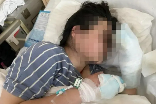 缩略图 | 女大学生东北游玩时晕倒冻伤，3根手指或面临截肢！