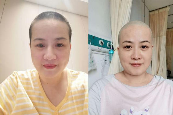 缩略图 | 岳云鹏老婆住院剃光头：粉丝捏把汗很担忧，本尊回应了