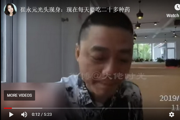 缩略图 | 崔永元光头现身：现在每天要吃二十多种药