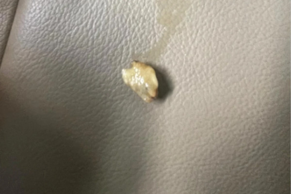 缩略图 | 震惊！渥太华男子在Tim Hortons咖啡里喝出疑似"人类牙齿"！